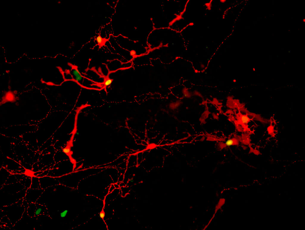 Against a black background, messy streaks of red illuminate the dark. They're retinal cells derived from human pluripotent stem cells.