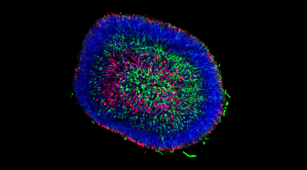 A microscopic image of a retinal organoid.
