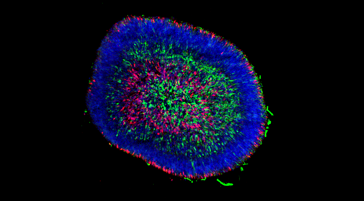 A microscopic image of a retinal organoid.