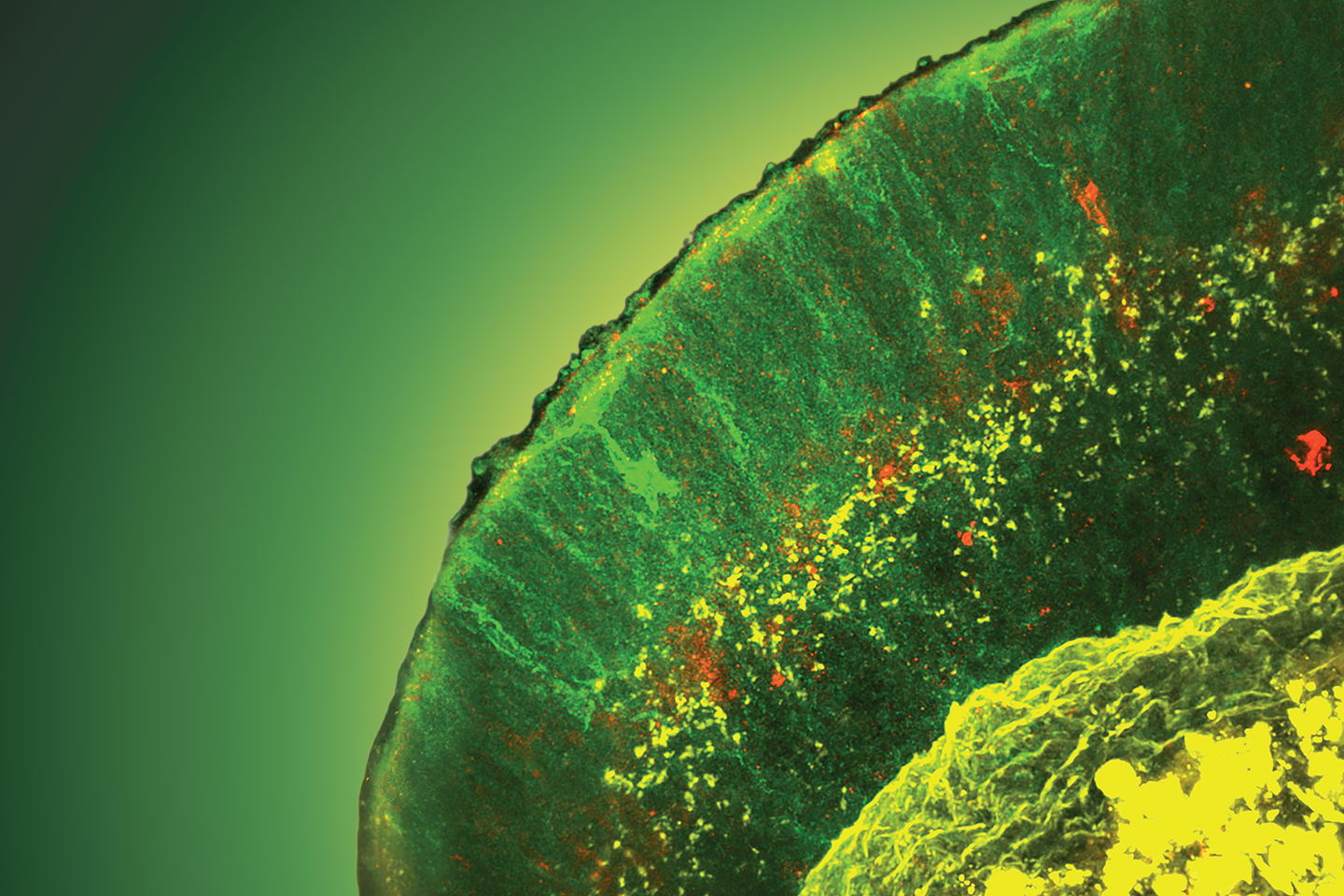 a fluorescent microscope image of a human 3D retinal organoid generated from stem cells.