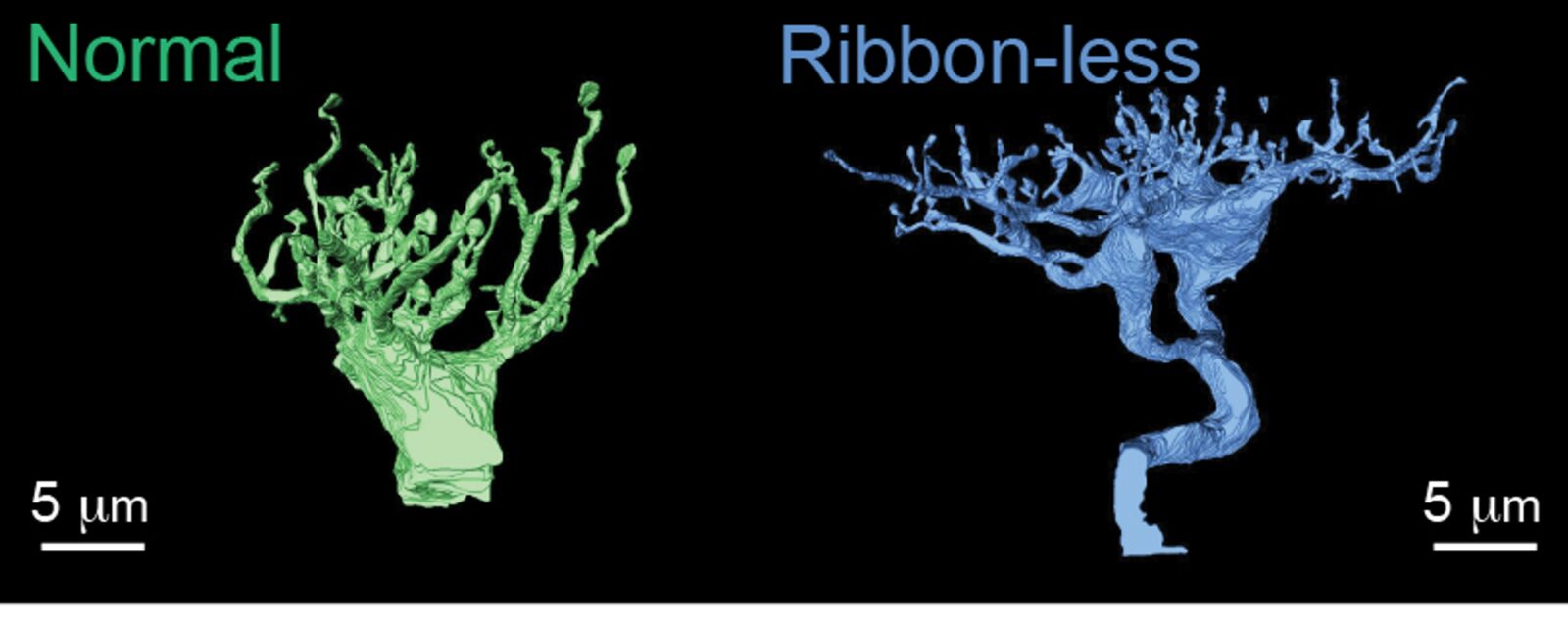 Retinal neurons expand their neuronal arbors erroneously in the ‘ribbon-less’ retina.